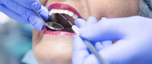 Best Emergency Treatment for Toothache in Flowood, MS