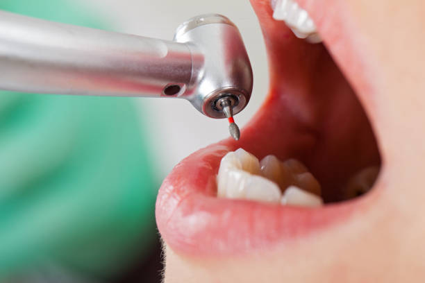 Best Pediatric Emergency Dentist in Flowood, MS